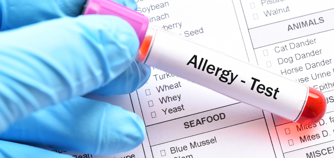 Czy alergia to choroba autoimmunologiczna?