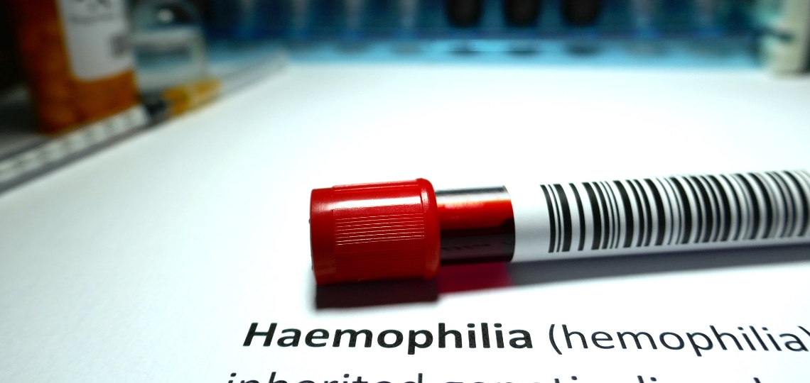 Zrozumieć hemofilię: najważniejsze fakty i wskazówki dla pacjentów