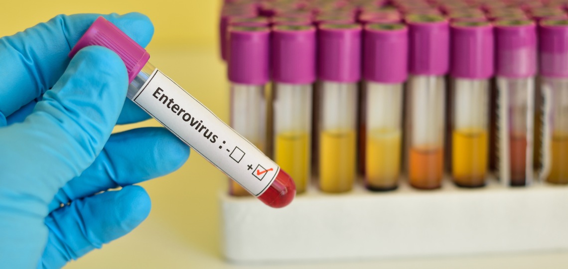 Enterowirusy - objawy, diagnostyka i leczenie
