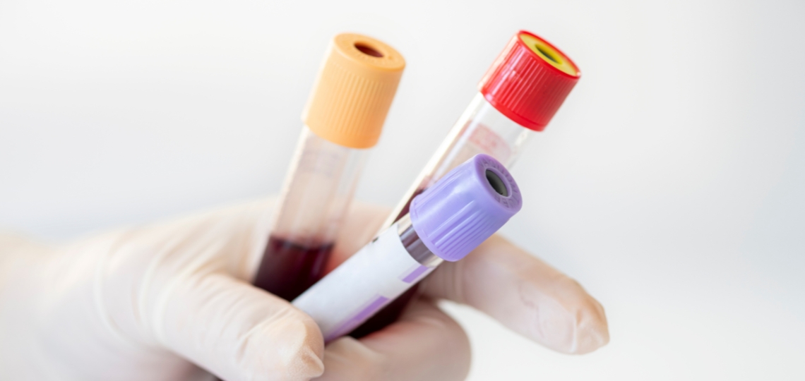 Zrozumieć neutrofile: klucz do silnego systemu immunologicznego