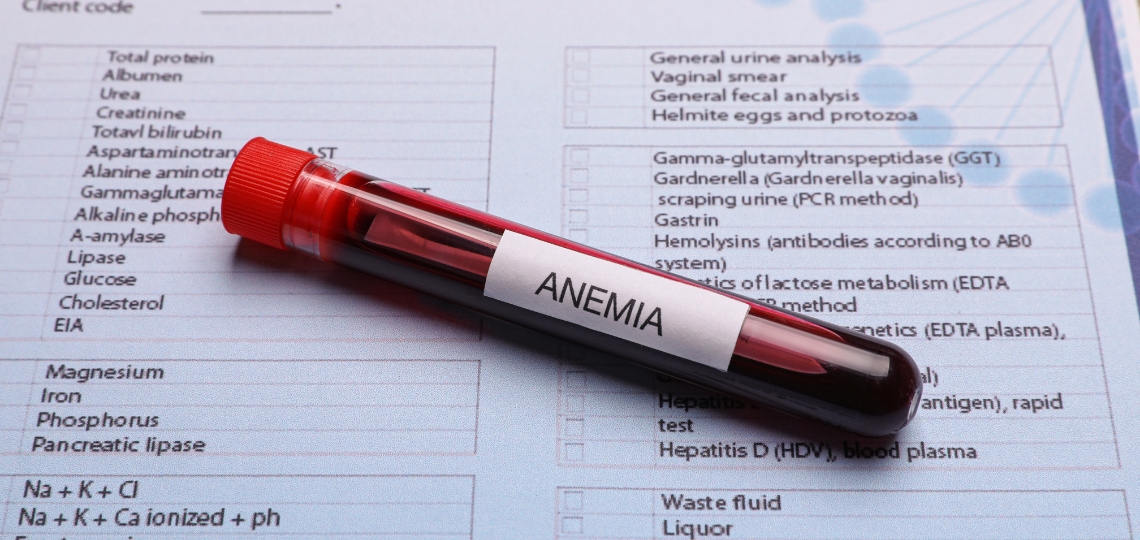 Anemia – przyczyny, objawy i leczenie