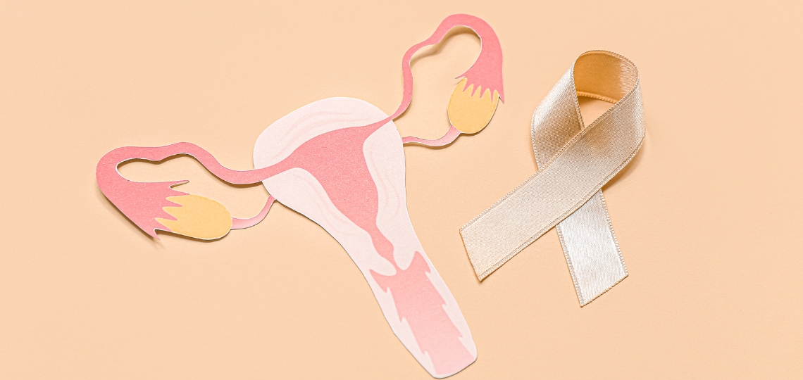 Endometrioza 