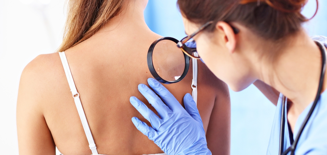 Rumień zakaźny - wizyta u dermatologa