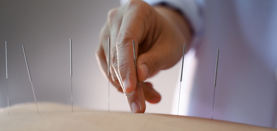 Akupunktura - na co pomaga? | Apteka Nowa Farmacja