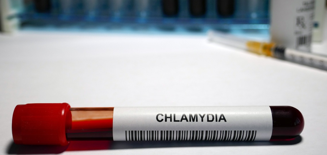 Chlamydia - co to jest? | Apteka Nowa Farmacja
