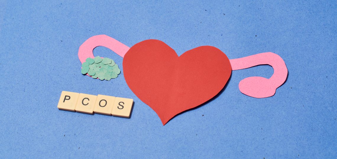 PCOS – przyczyny | Apteka Nowa Farmacja