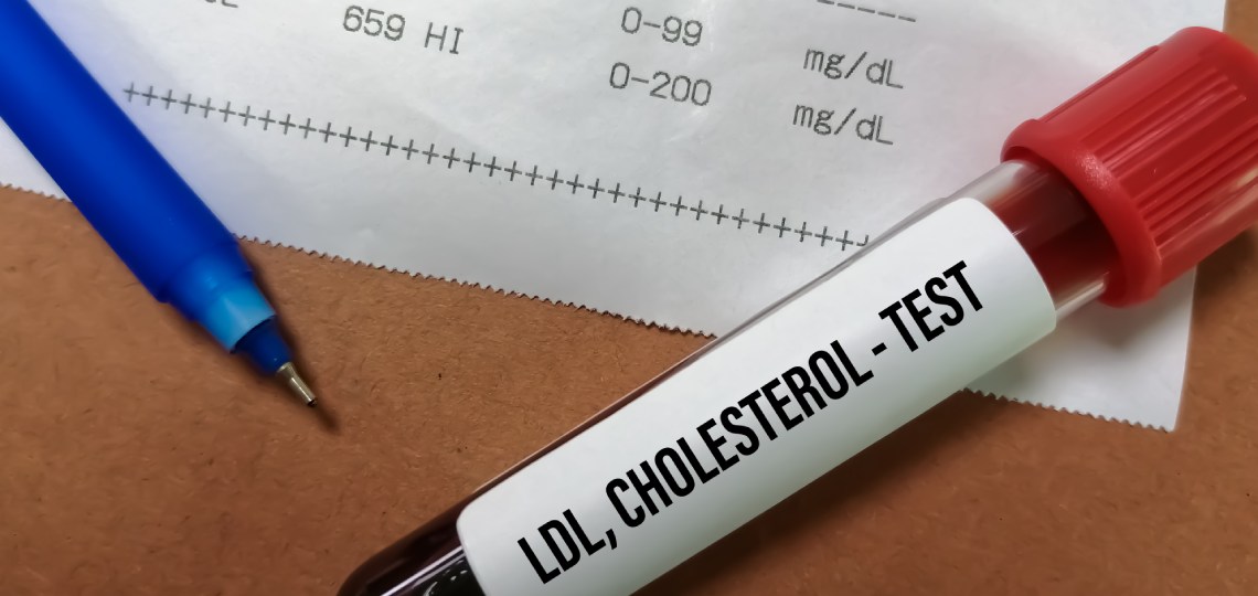 Dyslipidemia - co to za choroba? | Apteka Nowa Farmacja