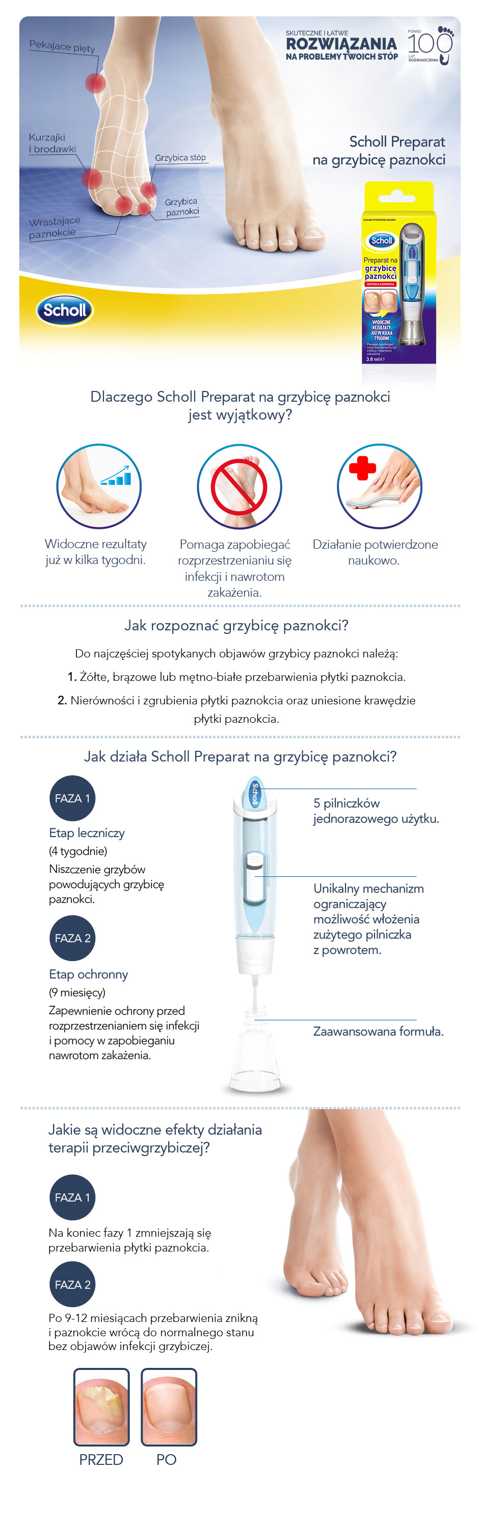 Scholl Zestaw na grzybicę stóp - 1 opakowanie